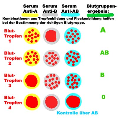 Blutgruppenbestimmung